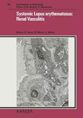 Couverture du produit · Systemic Lupus Erythematosus: Renal Vasculitis