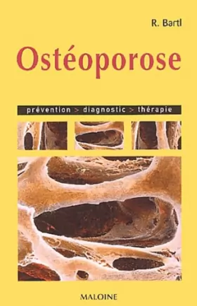 Couverture du produit · Ostéoporose: Prévention, diagnostic, thérapie