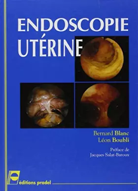 Couverture du produit · Endoscopie utérine