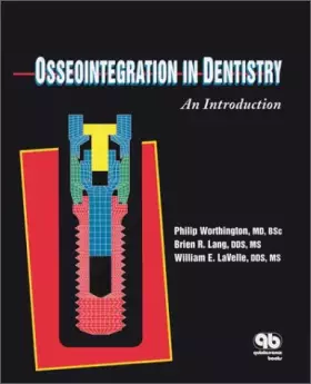 Couverture du produit · Osseo Integration in Dentistry: An Introduction