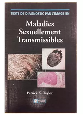Couverture du produit · Tests de diagnostic par l'image en maladies sexuellement transmissibles