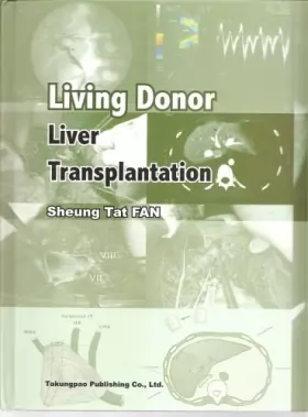 Couverture du produit · Living Donor Liver transplantation