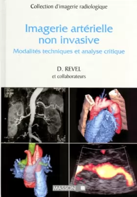 Couverture du produit · Imagerie Arterielle Non Invasive. Modalites Techniques Et Analyse Critique