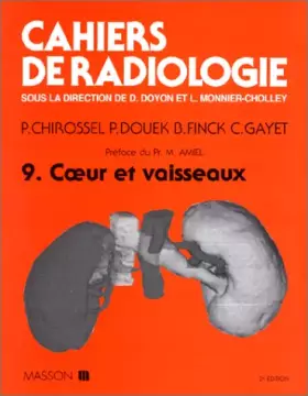 Cahiers de radiologie Tome 9: Coeur et vaisseaux - Pierre Chirossel, Philippe Douek, Bruno Finck et Christian Gayet