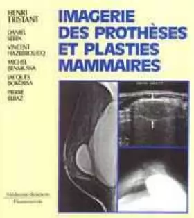 Couverture du produit · Imagerie des prothèses et plasties mammaires