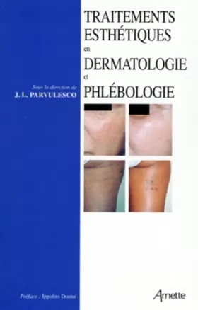 Couverture du produit · Traitements esthétiques en dermatologie et phlébologie