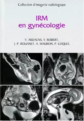 Couverture du produit · IRM en gynécologie