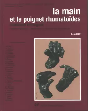 Couverture du produit · La main et le poignet rhumatoïdes : Traitement chirurgical, traitement médical, rééducation et réadaptation fonctionnelle