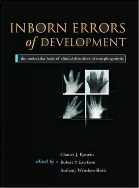 Couverture du produit · Inborn Errors of Development: The Molecular Basis of Clinical Disorders on Morphogenesis