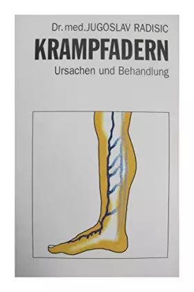 Couverture du produit · Krampfadern-Ursacehn und Behandlung. 1. Auflage. [Unbekannter Einband].