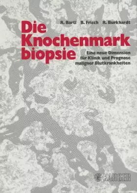 Couverture du produit · Die Knochenmarkbiopsie