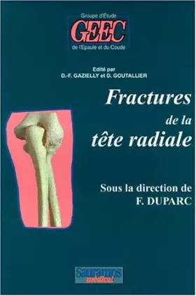Couverture du produit · Fractures de la tête radiale