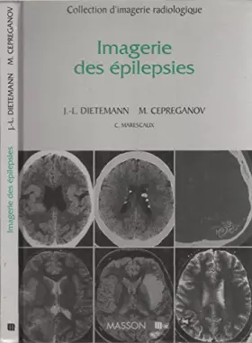 Couverture du produit · Imagerie des épilepsies