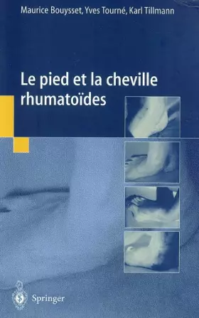 Couverture du produit · Le pied et la cheville rhumatoïdes