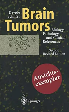 Couverture du produit · Brain Tumors: Pathology and Its Biological Correlates