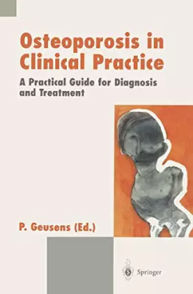 Couverture du produit · Osteoporosis in Clinical Practice: A Practical Guide for Diagnosis and Treatment