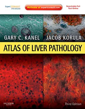 Couverture du produit · Atlas of Liver Pathology: Expert Consult - Online and Print (Atlas of Surgical Pathology)