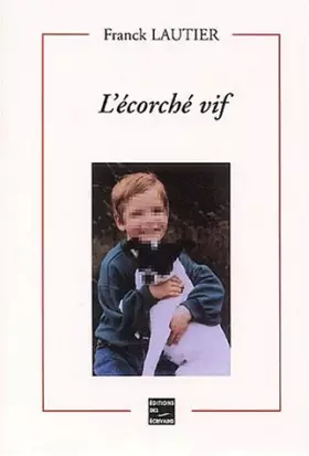 Couverture du produit · L'écorché vif