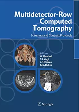 Couverture du produit · Multidetector-row computed tomography. Scanning and contrast protocols