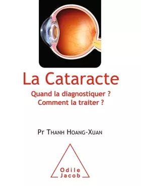Couverture du produit · La Cataracte: Quand la diagnostiquer ? Comment la traiter ?