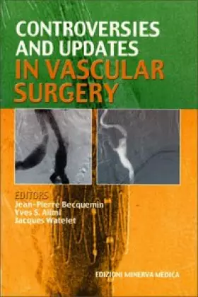 Couverture du produit · Controversies and updates in vascular surgery