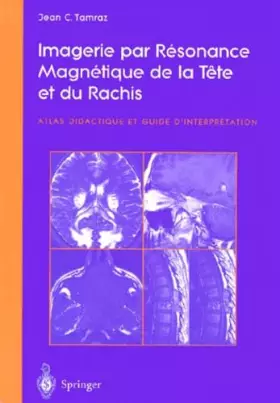 Couverture du produit · Imagerie par Résonance Magnétique de la Tête et du Rachis