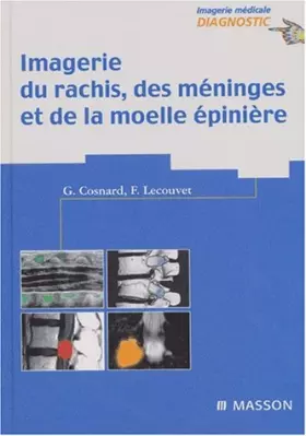 Couverture du produit · Imagerie du rachis, des méninges et de la moelle épinière
