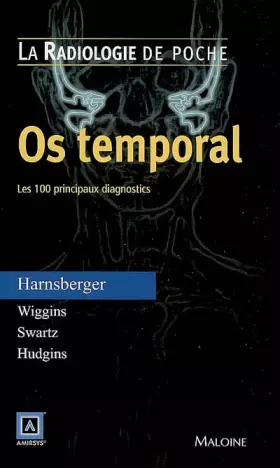 Couverture du produit · RADIOLOGIE DE POCHE - OS TEMPORAL. LES 100 PRINCIPAUX DIAGNOSTICS
