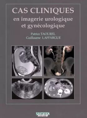 Couverture du produit · Cas cliniques en imagerie urologique et gynécologique