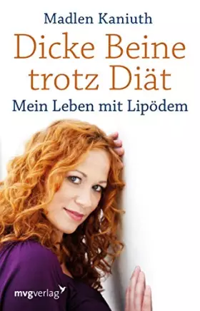 Couverture du produit · Dicke Beine trotz Diät: Mein Leben mit Lipödem