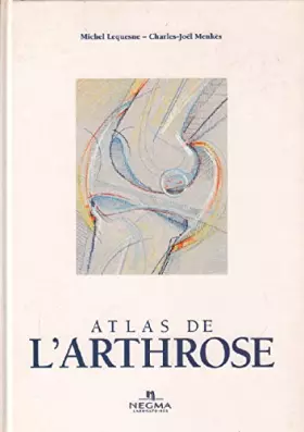 Couverture du produit · Atlas de l'arthrose