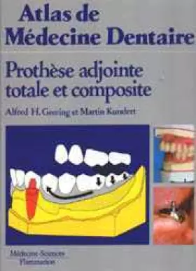Couverture du produit · Prothèse adjointe totale et composite