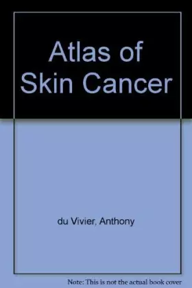 Couverture du produit · Atlas of Skin Cancer