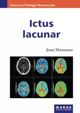 Couverture du produit · Ictus lacunar: 6 (Avances en Patología Neurovascular)