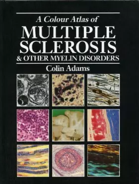Couverture du produit · A Colour Atlas of Multiple Sclerosis and Other Myelin Disorders
