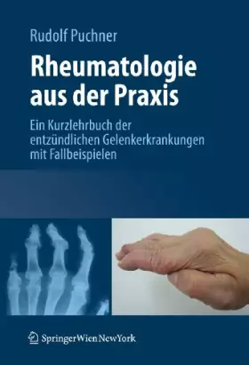 Couverture du produit · Rheumatologie aus der Praxis: Kurzlehrbuch der entzündlichen Gelenkerkrankungen mit Fallbeispielen