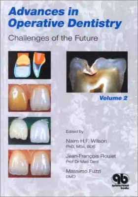 Couverture du produit · Advances in Operative Dentistry, Volume 2: Challenges of the Future