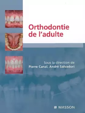 Couverture du produit · Orthodontie de l¿adulte: Rôle de l'orthodontie dans la réhabilitation générale de l'adulte
