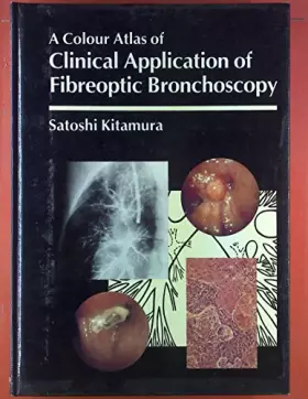 Couverture du produit · Clinical Application of Fibreoptic Bronchoscopy