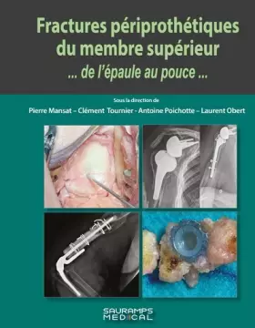 Couverture du produit · Fractures périprothétiques du membre supérieur...de l'épaule au pouce...