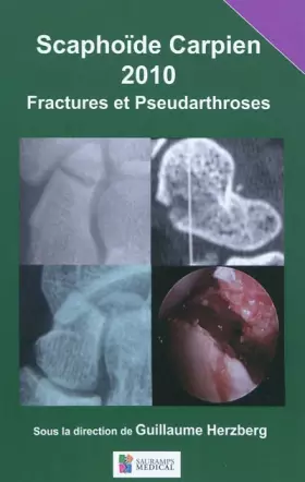 Couverture du produit · SCAPHOIDE CARPIEN 2010 FRACTURES ET PSEUDOARTHROSES