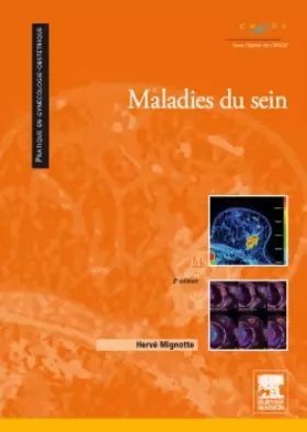 Couverture du produit · Maladies du sein