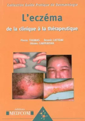 Couverture du produit · L'eczéma: De la clinique à la thérapeutique