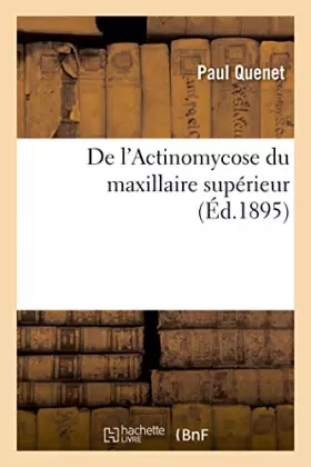 Couverture du produit · De l'Actinomycose du maxillaire supérieur