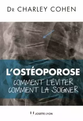 Couverture du produit · L'osteoporose - Comment l'éviter, comment la soigner