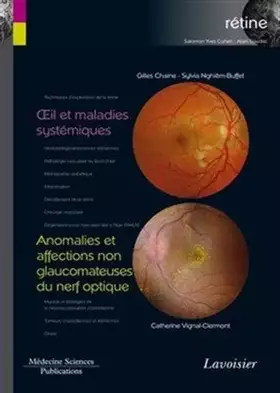 Couverture du produit · Oeil et maladies systémiques / Anomalies et affections non glaucomateuses du nerf optique (volume 5 - coffret Rétine): (volume 