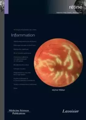 Couverture du produit · Inflammation (volume 4 - coffret Rétine): (volume 4 - coffret Rétine)