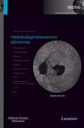 Couverture du produit · Hérédodégénérescences rétiniennes (volume 2 - coffret Rétine): (volume 2 - coffret Rétine)