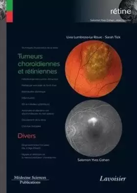 Couverture du produit · Tumeurs choroïdiennes et rétiniennes / Divers: (volume 8 - coffret Rétine)