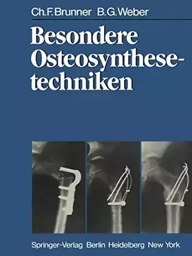 Couverture du produit · Besondere Osteosynthesetechniken